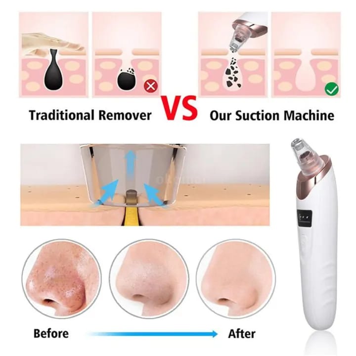 Derma Suction Machine-5 in 1 Blackhead Remover, Deep Cleansing Pore Vacuum